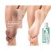 Bare 40 Urea Lotion 4 oz - Callus Remover & Moisturizer for Dry Cracked Heels - Rehydrates Rough Skin - Perfect for Feet, Elbows, Hands, and Nails - Buy Online on GoSupps.com