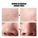 Organic Silkworm Silk Balls for Blackhead Removal - 30pcs Makeup Removal & Exfoliating Skincare - Buy Online on GoSupps.com