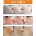  Gyiocill Anti-blemish cream freckle removal cream for face and body skincare product improves skin tone and quality suitable for all skin types - Buy Online on GoSupps.com