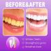Shop Sopami SP-7 Probiotic Toothpaste & Toothbrush - Whitening Stain Removal Fresh Breath Deep Clean Care - International Shipping Available - Buy Online on GoSupps.com