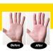 PediVac Electric Callus Remover with Built-In Vacuum - New Look | Removes Calluses & Dry Skin in Seconds | Mess-Free | 2000 RPMs | LED Light | 2 Speed Settings - Buy Online on GoSupps.com
