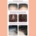 Srliya Hair Fibers for Thinning Hair Waterproof/Modification Hairline Powder Mushroom Head Puff Hair Line Topper for Fine Hair for Women & Men(Dark brown) - Buy Online on GoSupps.com