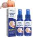 ZXBM Psoriasis Treatment Spray South Moon Psoriasis Repair Spray Herbal Psoriasis Treatment Spray Psoriasis Spray Psoriasis Treatment for Skin (2PCS)