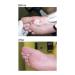 Dr. Nordyke's Wound Honey - 80g Manuka Honey for Infections, Burns, Cuts, and Scars - Buy Online on GoSupps.com
