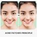 ACNE Patches - Miracle Hydrocolloid Spot Treatment for Blemishes & Breakouts | GO Acne GO - Fast Shipping Worldwide - Buy Online on GoSupps.com