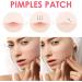 Pimple Patches Hydrocolloid Spot Remover Patches Spot Treatment Pimple Stickers Breakout Acne Patch Anti Acne Dots Made With Natural Oils Tea Tree and Calendula For Fast Acting Skincare - Buy Online on GoSupps.com