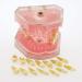 Buy Multifarious Dental Models for Teaching & Studying | Removable Teeth Implant & Orthodontic Demo Models (M7008) - Ideal for Dentists & Students - Buy Online on GoSupps.com