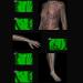 Adjustable Vein Viewers for Nurses | USB Camera Imaging IV for Accurate Venous Access | Ideal for Adults | Enhance Vein Puncture Success - Buy Online on GoSupps.com