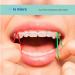 Neon Non-Latex 3 Packs 300 Count Orthodontic Elastics - Heavy 6.5oz - 3/16 Inch (4.8mm) - Dental Rubber Bands - Made in USA - Buy Online on GoSupps.com