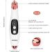 2022 Upgraded Blackhead Remover Pore Vacuum Kit | Facial Pore Cleaner Electric Acne Extractor Tool with 6 Probes | USB Rechargeable | For Women & Men | Suitable for Oil, Dry, and Mixed Skin - Buy Online on GoSupps.com