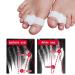 Reppkyh 8-Piece Bunion Corrector & Toe Separators | Soft Gel Spacer for Bunion & Overlapping Toe | 2 Loops Design | Effective Pain Relief - Buy Online on GoSupps.com