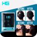 Hair Genetics Advanced Keratin Hair Fibers - Professional Hair Loss Concealer for Men & Women (Black 50g) - Money-Saving Refills - Buy Online on GoSupps.com