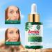 Tea Tree Oil for Face - Acne Serum & Blemish Spot Treatment - Unclogs Pores Soothes Breakouts - 1 fl oz for Smooth Glowing Skin - Buy Online on GoSupps.com