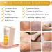 Silicone Scar Strips 1.6 x 6 Multi-Use Cream 8 Pcs - Reusable Scar Sheets for Scar Removal - 4 Month Supply - Buy Online on GoSupps.com