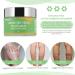 Veins Relief Cream for Fast Angiitis & Phlebitis in Knee & Legs - 3 Boxes | Varicose & Spider Veins Treatment Ointment | 6.5x6.5x5.2cm x 3pcs - Buy Online on GoSupps.com