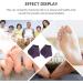 Milists 5 Pairs Moisturizing Gel Spa Socks for Cracked Heels - Heel Protection & Cushion | Slide-Resistant Foot Care - Buy Online on GoSupps.com