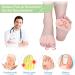 Metatarsal Pads - 4 PCS Ball of Foot Cushion & Toe Separators for Metatarsalgia Pain Relief - Men & Women - Buy Online on GoSupps.com