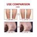 Varicose Vein Cream for Legs | Improve Blood Circulation & Strengthen Health | Effective Varicose Vein Treatment (1PC) - Buy Online on GoSupps.com