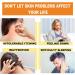 KCRPM Youth Bee Venom Psoriasis Treatment Cream - Soothing & Moisturizing Formula for All Skin Types | 1pcs - Buy Online on GoSupps.com