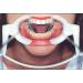 3 PCS Dental Orthodontic Dry System Cheek Retractor/Orthodontic Mouth Opener Dental Tool
