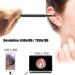 3-in-1 USB Earwax Removal Tool with HD Camera and LED Light - Ear Cleaner Endoscope for Adults, Kids, and Pets - Compatible with Android Smart Phones - Buy Online on GoSupps.com