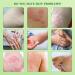 Buy Anti-Itch Cream | Herbal Antibacterial Eczema Treatment for Allergic Dermatitis - Ships Worldwide - Buy Online on GoSupps.com