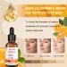 Buy Vitamin C Serum for Face - Brightening Anti-Aging Acne & Dark Spot Treatment | 30ml Moisture Facial Serum - Buy Online on GoSupps.com