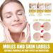 (Must - Have) Super Luxe Skin Re_mover Super Luxe Skin Re_moval Skin Tag Re_mover Cream Painless Mole and Skin Re_mover for All Skin Types (2PC) - Buy Online on GoSupps.com