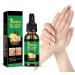 dizhenhui104jiaju LYEAA Nail fungus treatment 7 days nail fungus treatment toenails cuticle care oil ginger nail serum nail strengthening oil for damaged nails 2 pieces - Buy Online on GoSupps.com