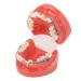 Buy GFRGFH Dental Model with 24 Teeth - Half Metal Half Ceramic Bracket for Teaching & Study - International Shipping Available - Buy Online on GoSupps.com