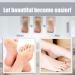 Extra Coarse Mineral Replacement Rolls for Velvet Smooth Callus Remover - Diamond Particle Refills for Smooth Feet | International Shipping Available - Buy Online on GoSupps.com