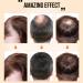 AUklOPVZZ Ginger Hair Growth Products Prevent Hair-Loss Regrowth Essential Oil Professional Smoothing Nutrient Solution for Men - Buy Online on GoSupps.com