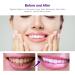 Purple Teeth Whitening Foam - Stain Removal & Whitening Booster (50ml) - Buy Online on GoSupps.com