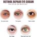 Retinol Eye Cream Eye Cream for Dark Circles Puffy Eyes Anti Wrinkle Eye Cream Firming Eye Cream Against Wrinkles with Retinol and Hyaluronic Acid Eye Cream Anti Aging for All Skin Types - Buy Online on GoSupps.com