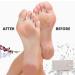 Pumice Stone Foot Scrubber for Dead Skin Removal - Natural Exfoliator & Callus Remover for Clean, Smooth Feet - Buy Online on GoSupps.com