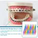 ZOKJSW Orthodontic Elastic Disposable Plastic Braces - 20 Mixed Color Pack for Comfortable Dental Care | International Shipping Available - Buy Online on GoSupps.com