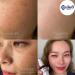 Yanhee Premium Serum Extract & Mela Cream Tranexamic Acid Set | Superior Skincare for Radiant Skin - International Shipping Available - Buy Online on GoSupps.com