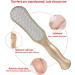 Stainless Steel Hornhaut File for Foot Care | Miaozhang Cornal Remover & Pedicure Tool - Buy Online on GoSupps.com