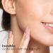 NOACNE Hydrocolloid Pimple Patches - 144 Dots Anti Blemish Acne Treatment Sticker - Buy Online on GoSupps.com