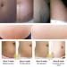 RtopR Mango Stretch Marks & Scar Cream - Pregnancy Safe Removal Moisturizer 40g - 1.41 Ounce - Buy Online on GoSupps.com