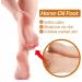 Horse Oil Foot Repair Cream 3Pcs 30g Foot Care Cream Easily Absorbed Moisturizing Horse Oil Foot Care Cream for Extremely Dry Cracked Feet - Buy Online on GoSupps.com