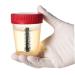 Urine Temp Strips 25pcs | Fish Tank Test Strips | Urinalysis Sticker - Buy Online on GoSupps.com