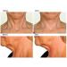 Neck Rescue Instant Correcting Strips - Improve & Tighten Neckline - 30 Count - Buy Online on GoSupps.com
