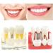 Buy Implant Model 4-Fold Removable Bridge for Dental Training - International Shipping Available - Buy Online on GoSupps.com