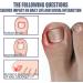 Ingrown Toenail Treatment Nail Helper Nail Growth Treatment Ingrowing Toenail Treatment Ingrown Toenail Corrector Treatment For Ingrown Toenail Ingrowing Toenail Cuticle Oil Nail Growth Treatment - Buy Online on GoSupps.com