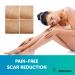 AWD Silicone Scar Sheets for Effective Scar Removal | Surgical C Section Keloid Tummy Tuck Tape - 5 Pcs 1.6 x 6 Nude - Must-Have Skin Patches - Buy Online on GoSupps.com