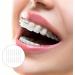 Doitool 40PCS Orthodontic Ligature Ties - Dental Braces Bands & Rings for Effective Orthodontic Care | International Shipping Available - Buy Online on GoSupps.com
