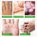 Hand Care Mask - 3 Pairs Moisture Gloves for Anti-Aging & Hydration | Dry Cracked Hands Treatment for Men & Women - International Shipping - Buy Online on GoSupps.com