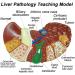 Teaching Model Human Liver Model with Base and Clear Texture and Pathological Features Liver Pathology Teaching Model for Teaching Models Doctor-Patient Communication - Buy Online on GoSupps.com