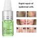 Mole Removal Cream Pigment Repair Gel Melanin Spot Corrector Cream Crea for Skin Brightening & Pigment Removal Dark Spot Recovery Solution - Buy Online on GoSupps.com